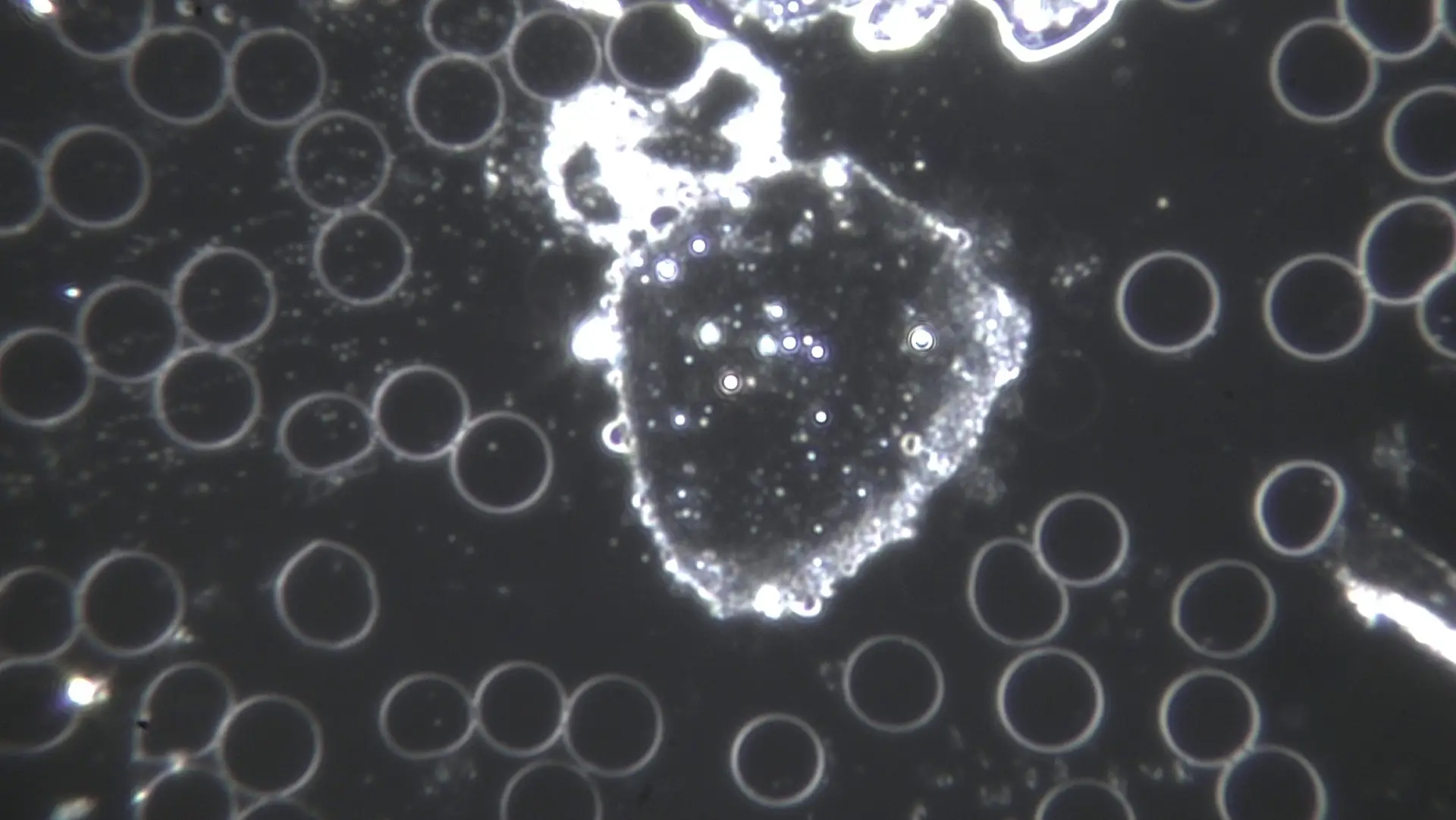 Blutbild Dunkelfeldmikroskopie