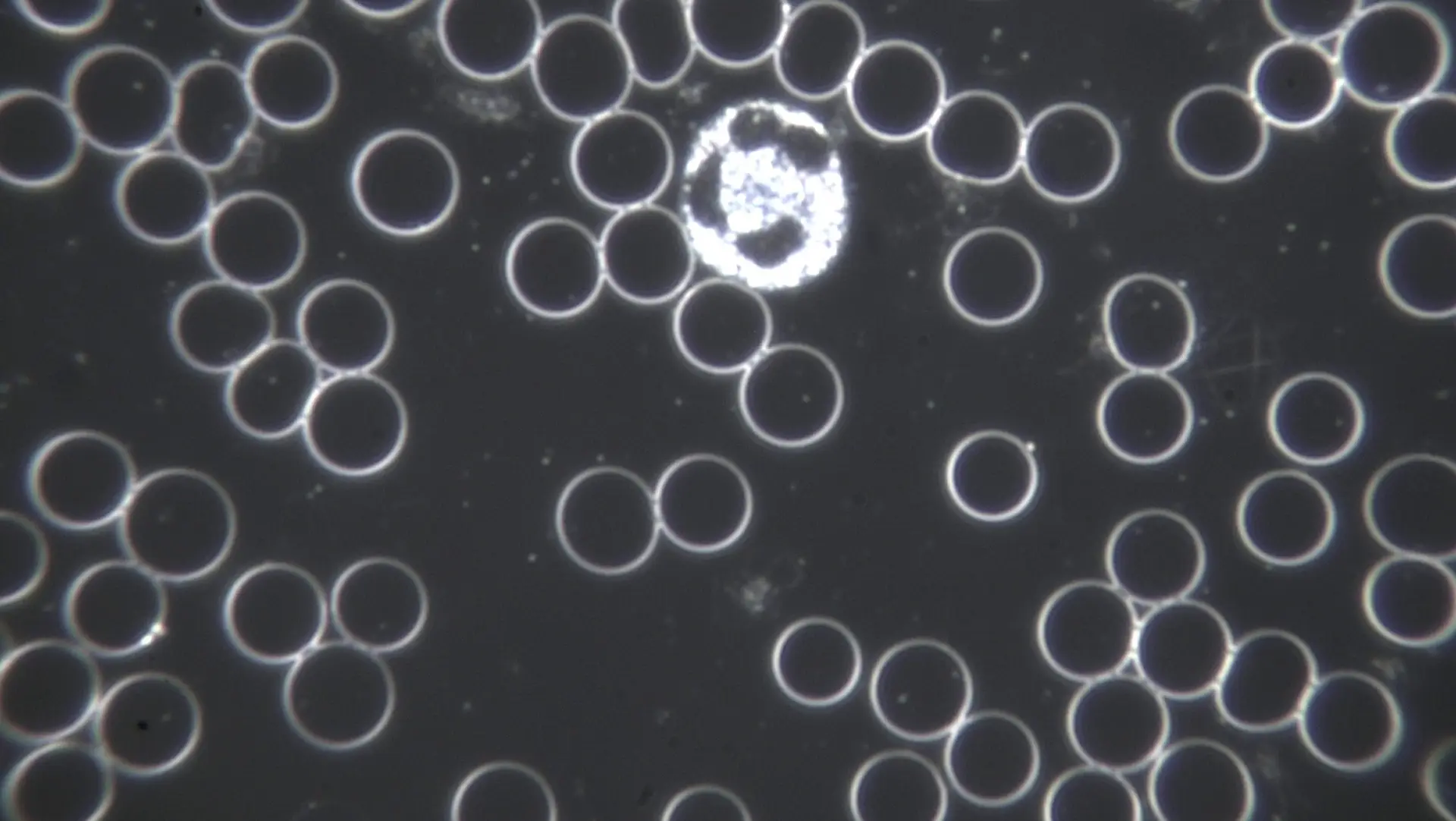 rote und weiße Blutkörperchen