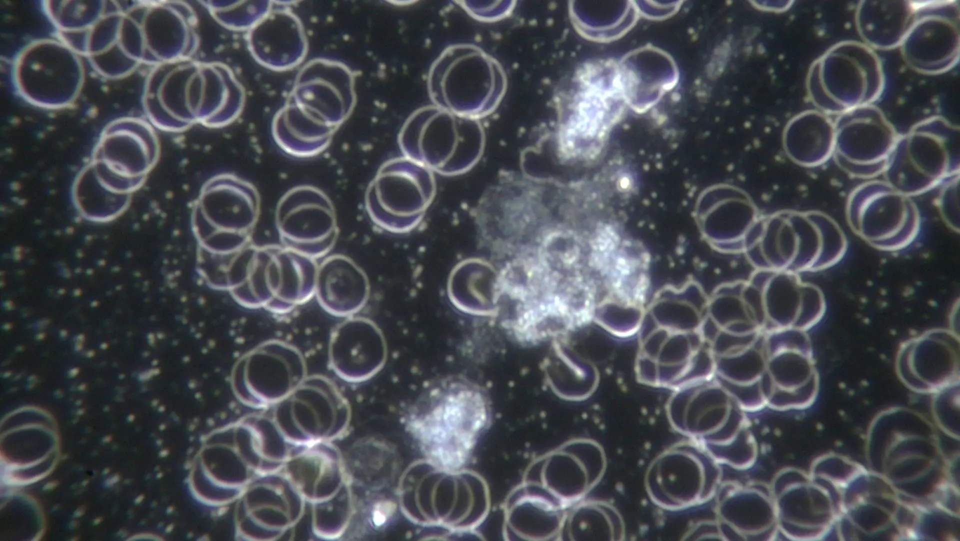 mehrere weiße Blutkörperchen in direktem Kontakt