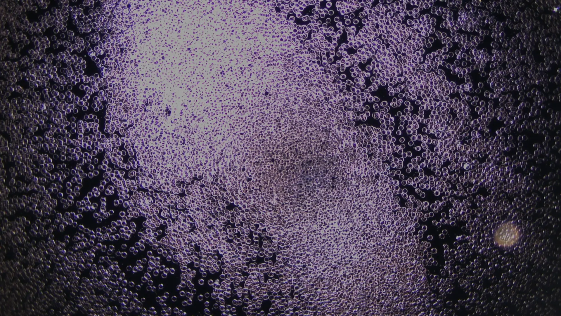 Dunkelfeldmikroskopie Zusammenballung